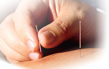 acupuncture2 Acupuncture Therapy
