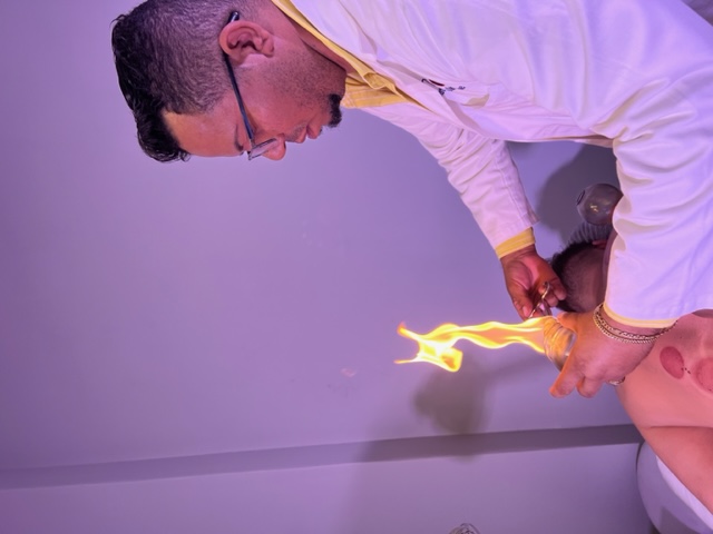 Fire Cupping Therapy